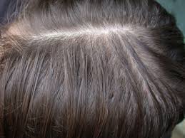 Como-tratar-a-oleosidade-dos-cabelos-4